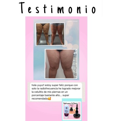 YUYU-FOR-YOU-RADIOFRECUENCIA-CORPORAL-GEL-REDUCTOR-MSC132