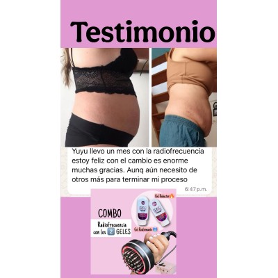 YUYU-FOR-YOU-RADIOFRECUENCIA-CORPORAL-GEL-REDUCTOR-MSC132