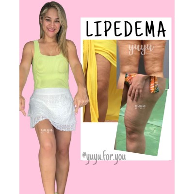 combo lipedema. yuyu for you. combo 13-1, elimina celulitis, grasa
