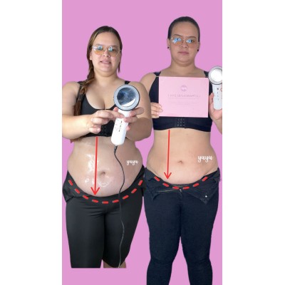 Mejora la Flacidez con Radiofrecuencia, Ultrasonido y Crio.