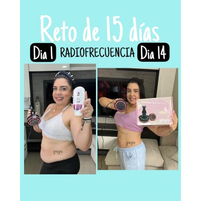 COMBO RADIOFRECUENCIA CON GEL FRIO Y GEL CALIENTE. yuyu for you- reduce grasa y flacidez