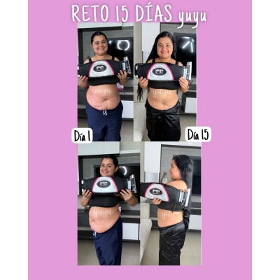 Complementa tu GYM con Radiofrecuencia, Faja Vibro y Criolipolisis.